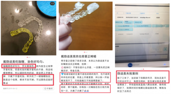 扒一扒为什么隐适美更有名,但大多数人做牙齿矫正还是选择时代天使？